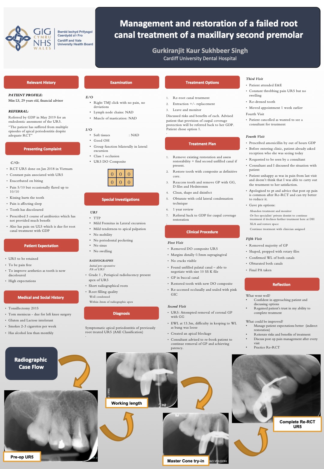 Poster Management and restoration of a failed root canal treatment of a maxillary second premolar